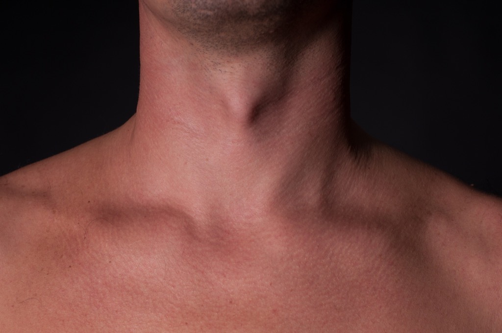 Adam's apple Health Boosters