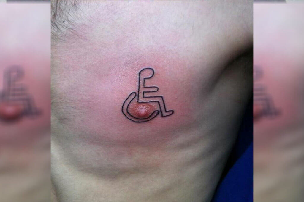 The Disabled Nipple