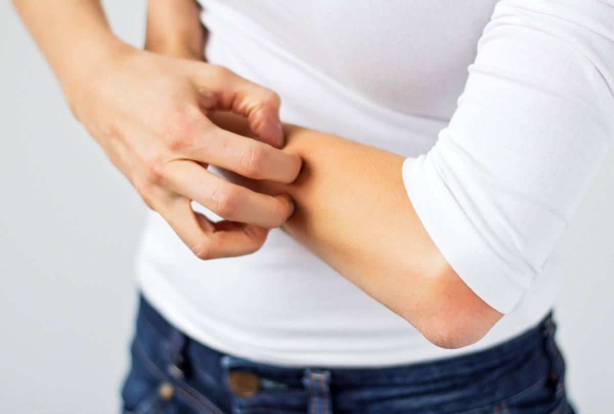 Woman scratching her arm.