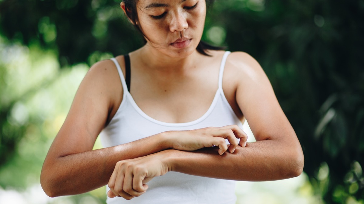 Young women hand scratch the itch on the arm, healthcare