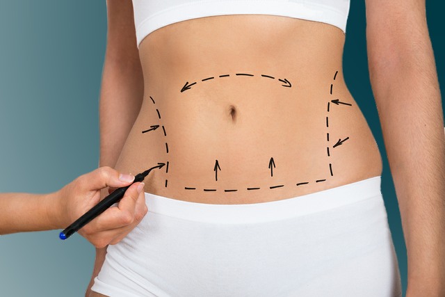 Board-certified plastic surgeon | Everything To Know About The Non Surgical Tummy Tuck | Her Beauty