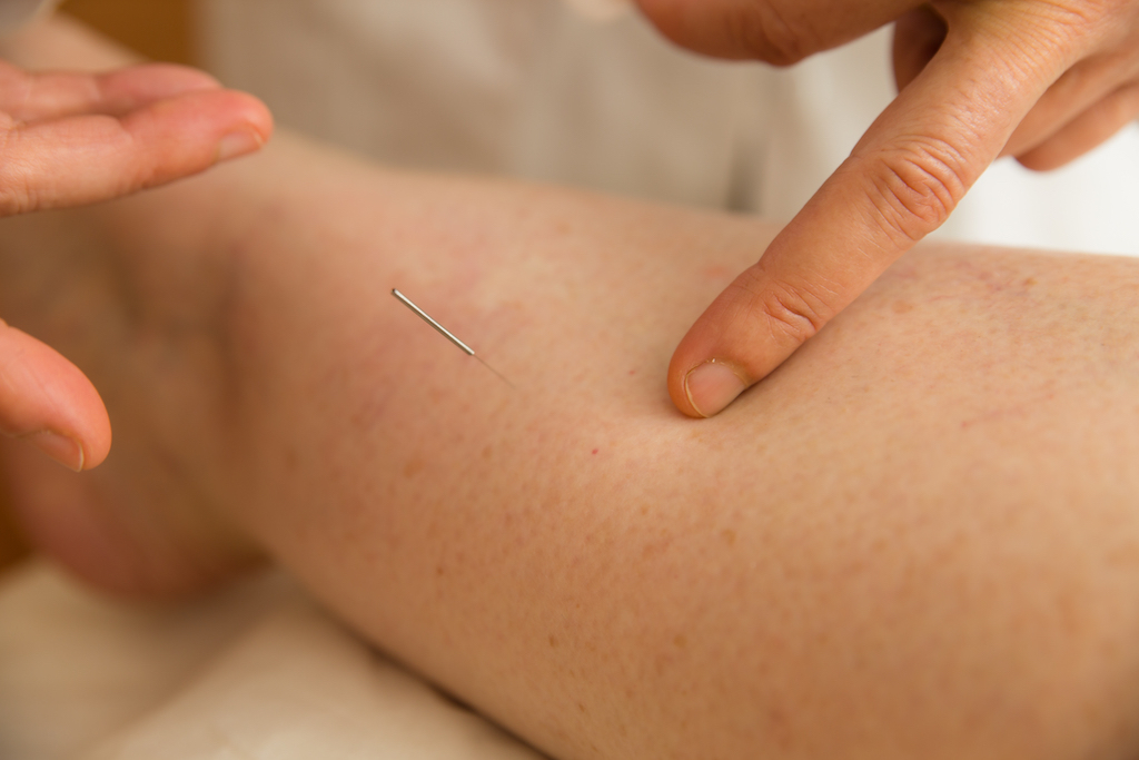 Acupuncture Summer